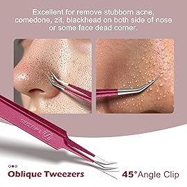 WSYUB Blackhead Remover Tweezers,Professional Facial Blackhead Tweezers,Ingrown Hairs TweezersPimple Popper Tool Kit, Dermatologist Tweezers for Acne Removal, Extraction Tweezers