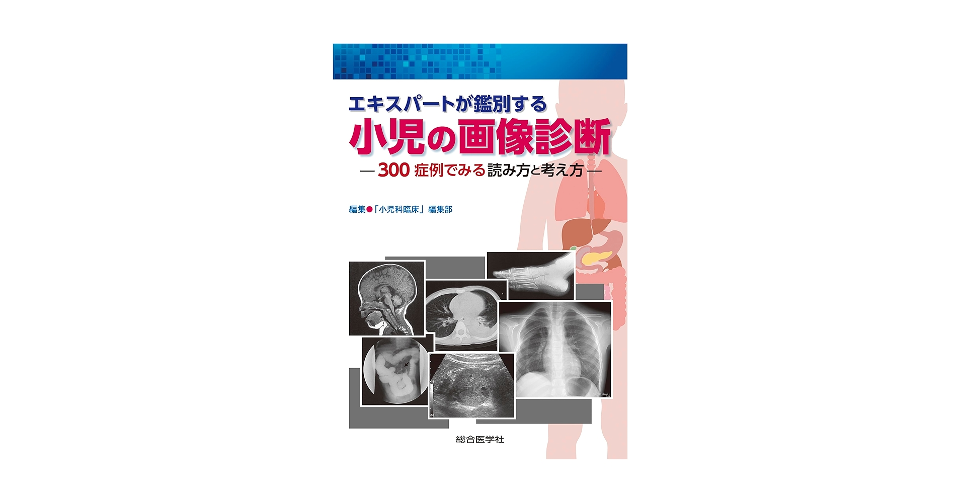 裁断済　エキスパートが鑑別する小児の画像診断 : 300症例でみる読み方と考え方 エキスパートが鑑別する 小児の画像診断: 300症例でみる読み方と