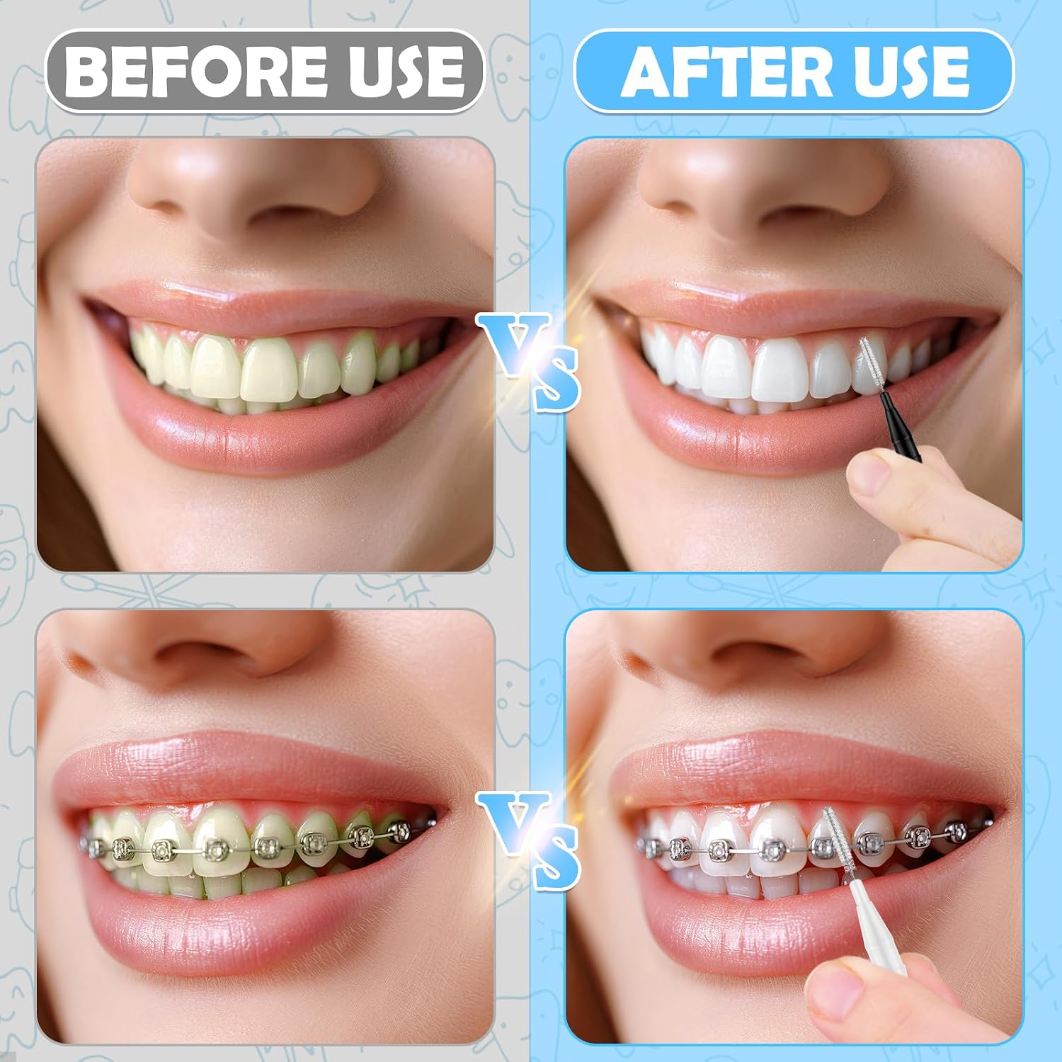 ROADPLUM 120Pcs Interdental Brushes, 360° Bendable Soft Bristles Braces Flossers Dental Brushes Between Teeth Gum Interdental Brushes for Gum Braces Oral Teeth Cleaning Tool (Black, White) image 2