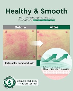 EASYDEW Barrier Repair Cream - Intense Hydration and Skin Barrier Restoration Face Moisturizer for Damaged and Irritated Skin with Cica, Hyluronic Acid, Collagen, 1.01 fl.oz.