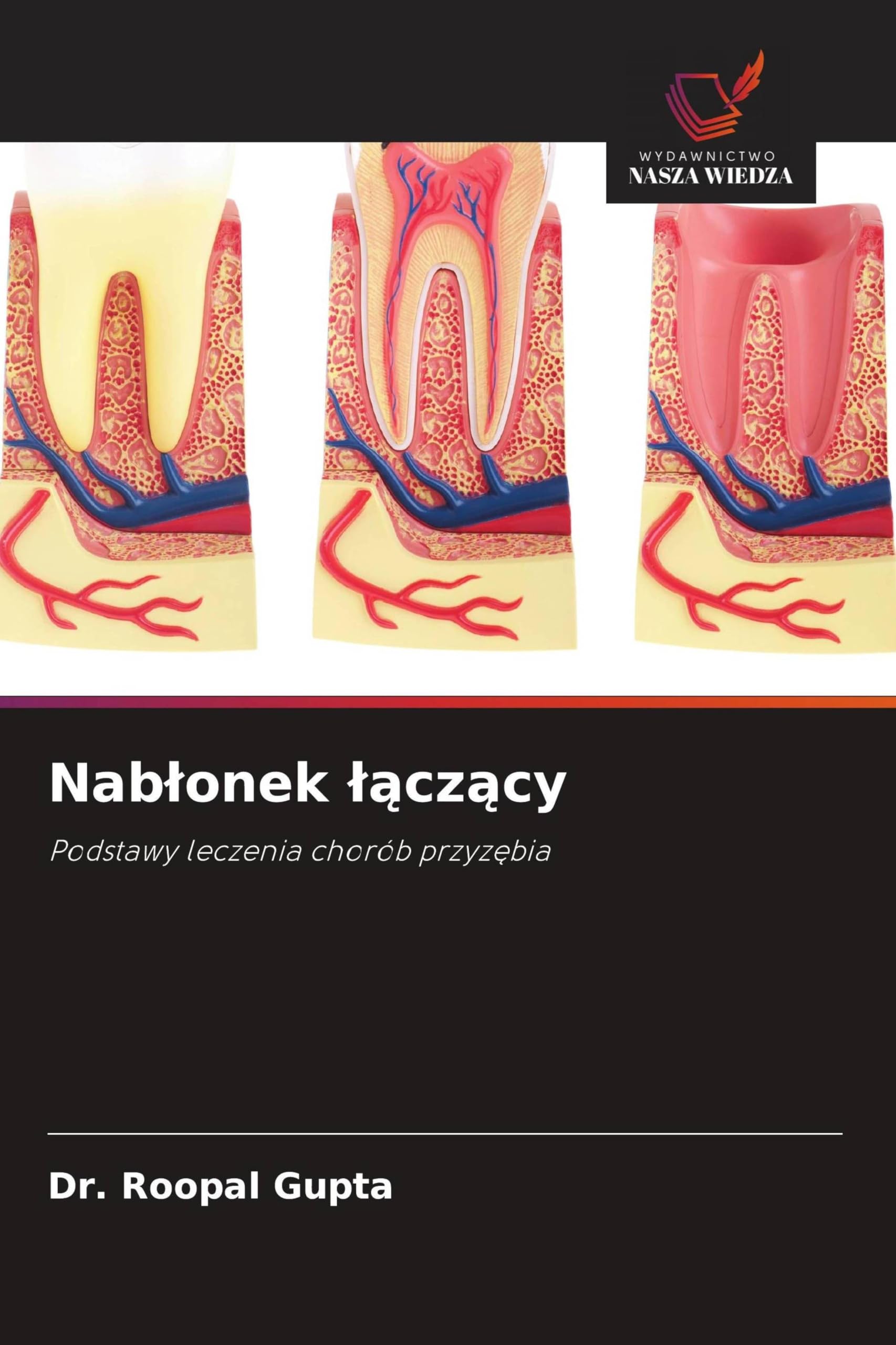 Nablonek lączący: Podstawy leczenia chorób przyz¿bia