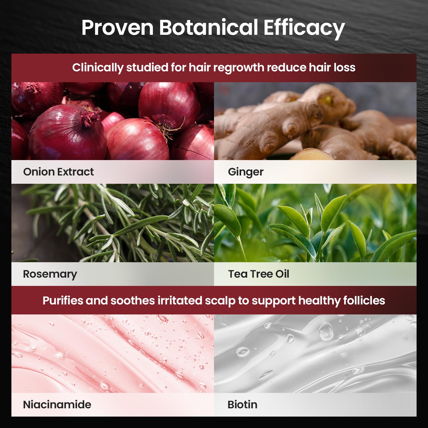 Champú para el crecimiento del cabello con cebolla y biotina: infundido con aceite natural de romero y árbol de té Tratamiento anti pérdida de cabello - El cuero cabelludo suaviza la fórmula para 5