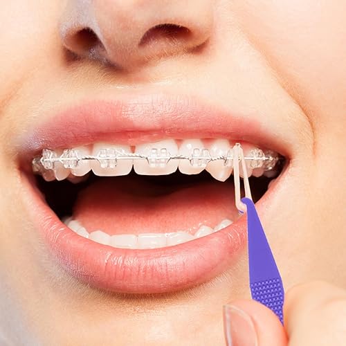 Miniatura 6 de 30 unidades de bandas elásticas dentales multicolor para aparatos ortopédicos desechables de plástico ortodóncico