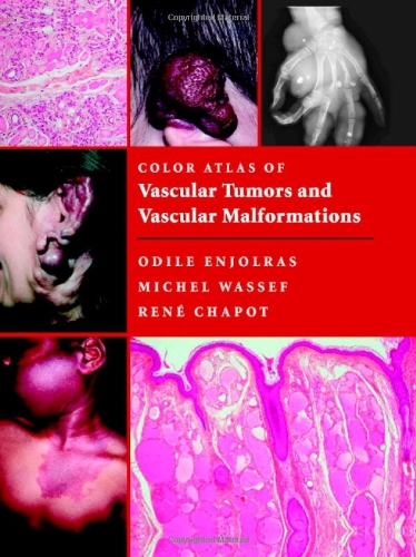 Buy Color Atlas of Vascular Tumors and Vascular Malformations — BookShops.in