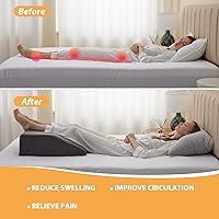 Vista 3 de Bedluxe Almohadas de elevación de piernas, almohadas de piernas para dormir, parte superior de espuma viscoelástica de gel refrescante, almohada