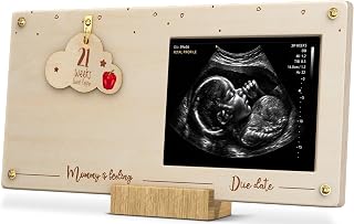 Pregnancy Milestone Countdown Board with Ultrasound Picture Frame – Customizable Keepsake Gift for Expecting Moms, Baby Shower, Gender Reveal & Due Date Tracker