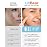 LitBear Large Acne Pimple Patches, 5 Sizes 80 Patches for Large Breakouts, Acne Patches for Face, Chin or Body, Acne Spot Patch with Tea Tree & Calendula Oil, Hydrocolloid Bandages for Acne Skin