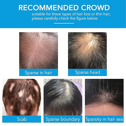 Miniatura 8 de Fibras de construcción del cabello, fibras engrosadoras del cabello para cabello fino y puntos calvos, cabello más grueso y lleno en 15 segundos,