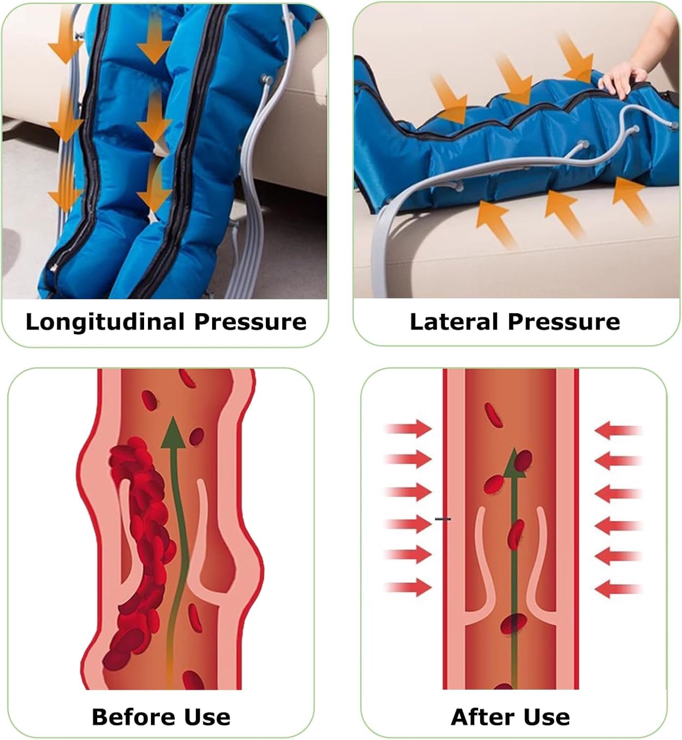 Lymphdrainage Gerät Beine Und Bauch Und Arme Bei Lipödem, 6 Kammern Beinmassagegerät Für Die Lymphdrainage Professionelles, Massagegerät Beine Lipödem & Schwellungen, 30-240mmhg Einstellbarer