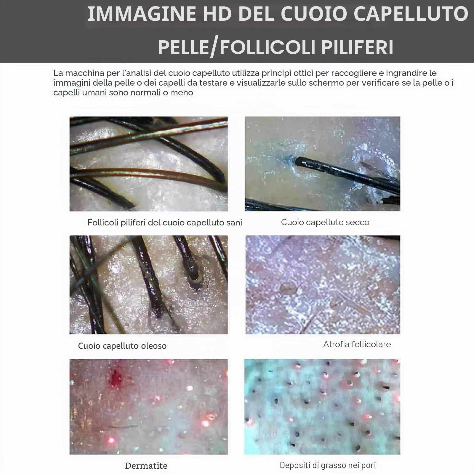 Analizzatore per Capelli E Pelle Microscopio Digitale LCD 10 in Portatile per Rilevatore Cuoio Capelluto, Macchina per Analisi Capelli Macchina Analisi Pelle Rilevatore Follicolo Pilifero
