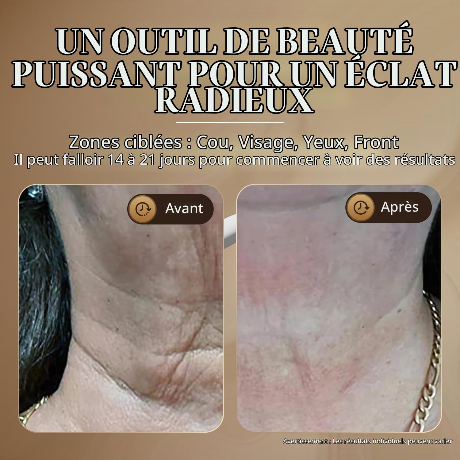 GLO24K Beauty device for skin rejuvenation on the face and neck Based on triple action LED technology, thermal and vibration Lifts and tightens sagging skin for a glowing appearance.