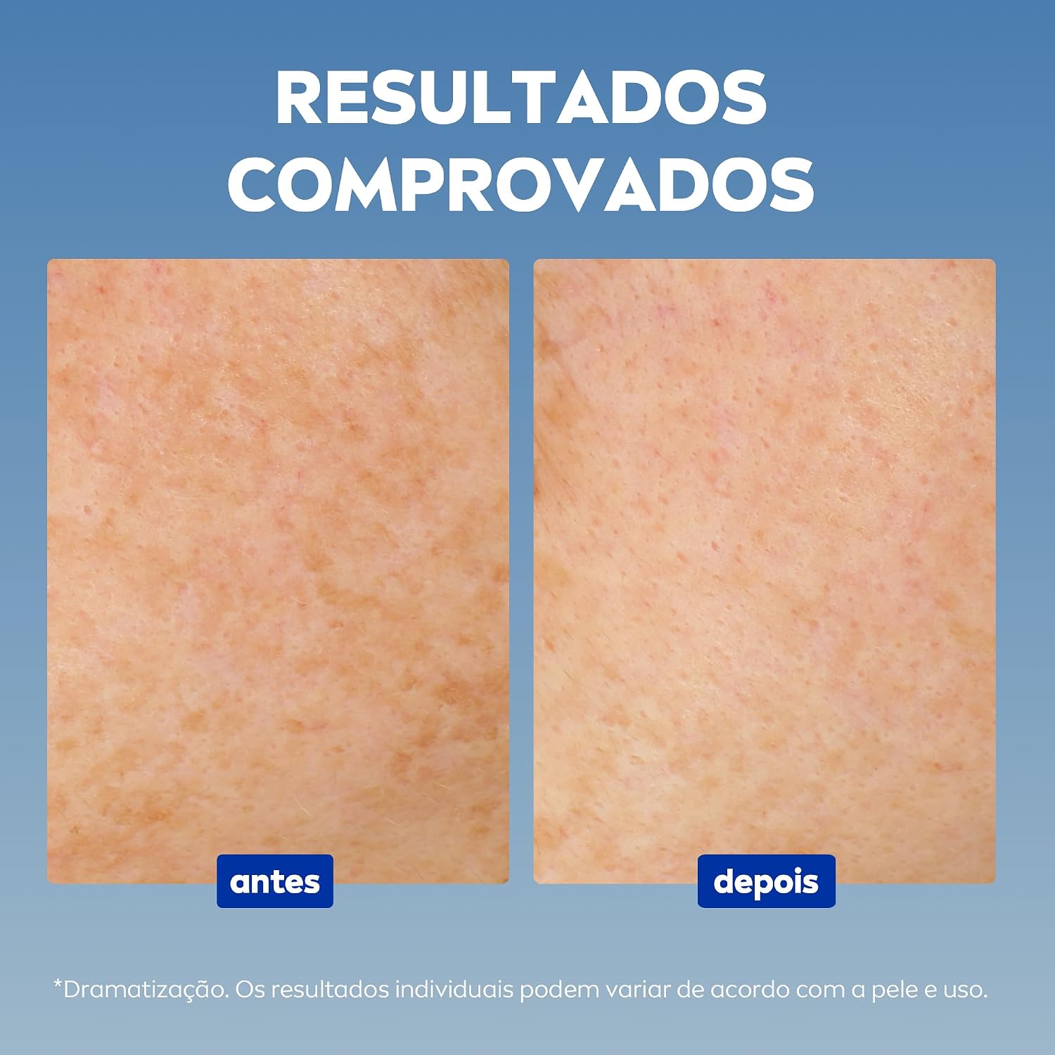 NIVEA Sérum Facial Cellular Luminous 630® ANTIMARCAS Anti-idade 30ml