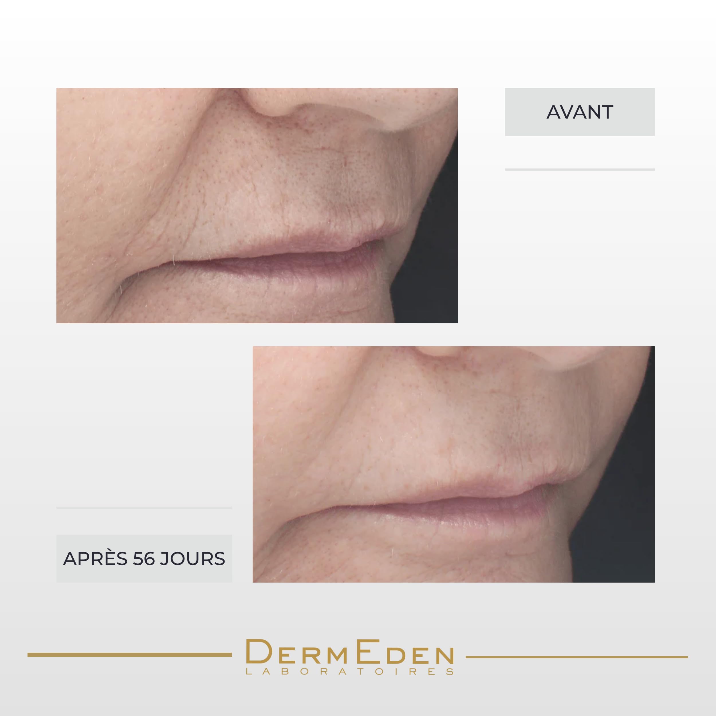 Laboratoires DermEden - Concentré Rétinal Nuit 30 ml - Réduit les rides, Stimule le collagène et Améliore la fermeté de la peau - Rétinal - Fabrication Française