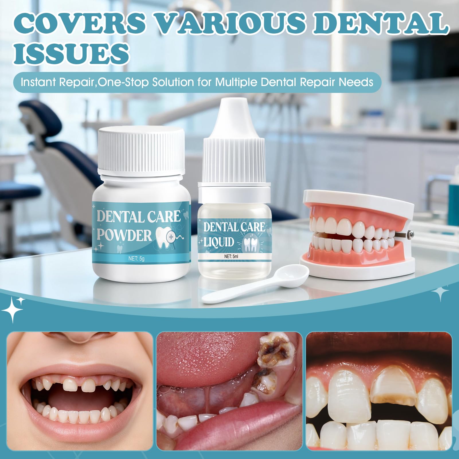 Pegamento Dental Cemento Kit de Fijación para Corona Puente Rellenar Caries