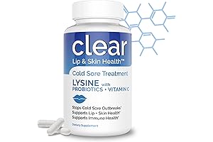 Cold Sore Treatment Lips: Lysine Complex with Acidophilus Probiotic & Lactobacillus Rhamnosus...