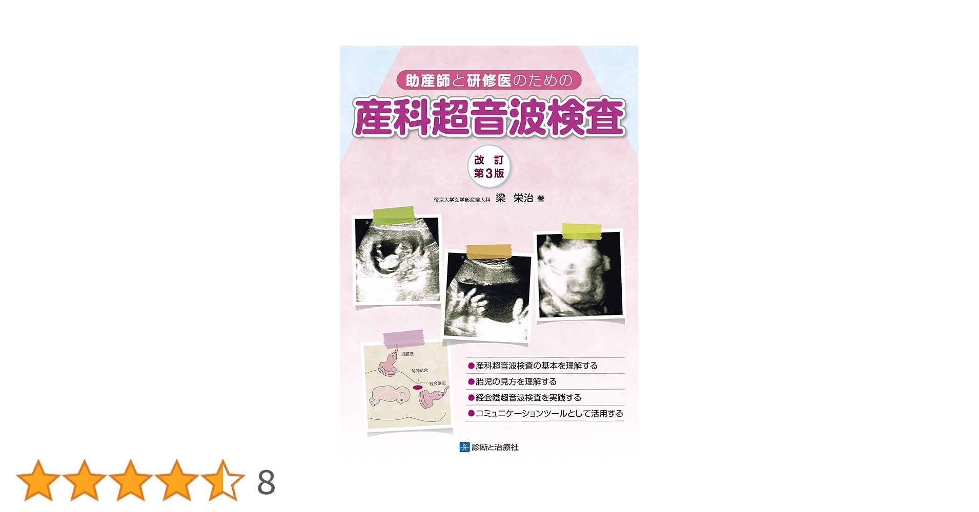 超音波検査技術　第38巻5号〜第49巻第6号　参考書 Amazon.co.jp: 腹部超音波検査ドリル : 土居忠文, 上田彩未: 本