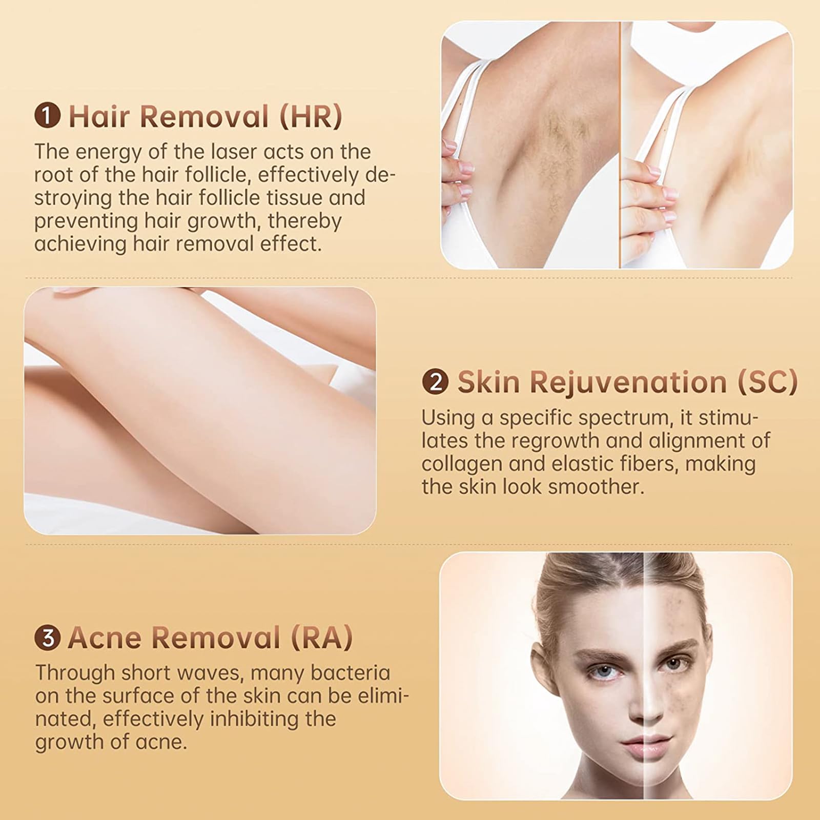 IPL -Laser - Geräte Haarentfernungs für Frauen und Männer, 9 Energieniveaus, 999.000 Blitze, zu Hause sicher für Gesicht, Körper, Bikini & Back