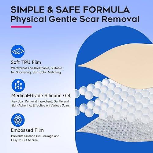 Miniatura 4 de EzonaCare Hojas de cinta de silicona más gruesas, rollo de cinta para cicatrices (118 x 16 pulgadas) eficaz, fuerte adherencia, hojas de cicatrices