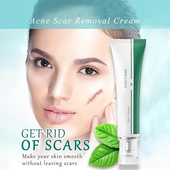 Scar Cream, Face Pimples Scar Stretch Marks Cream Moisturizing Repair Damaged Skin Gel Scar Treatment