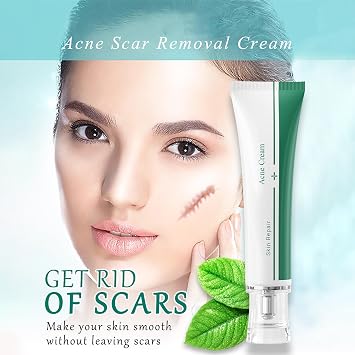 Scar Cream, Face Pimples Scar Stretch Marks Cream Moisturizing Repair Damaged Skin Gel Scar Treatment
