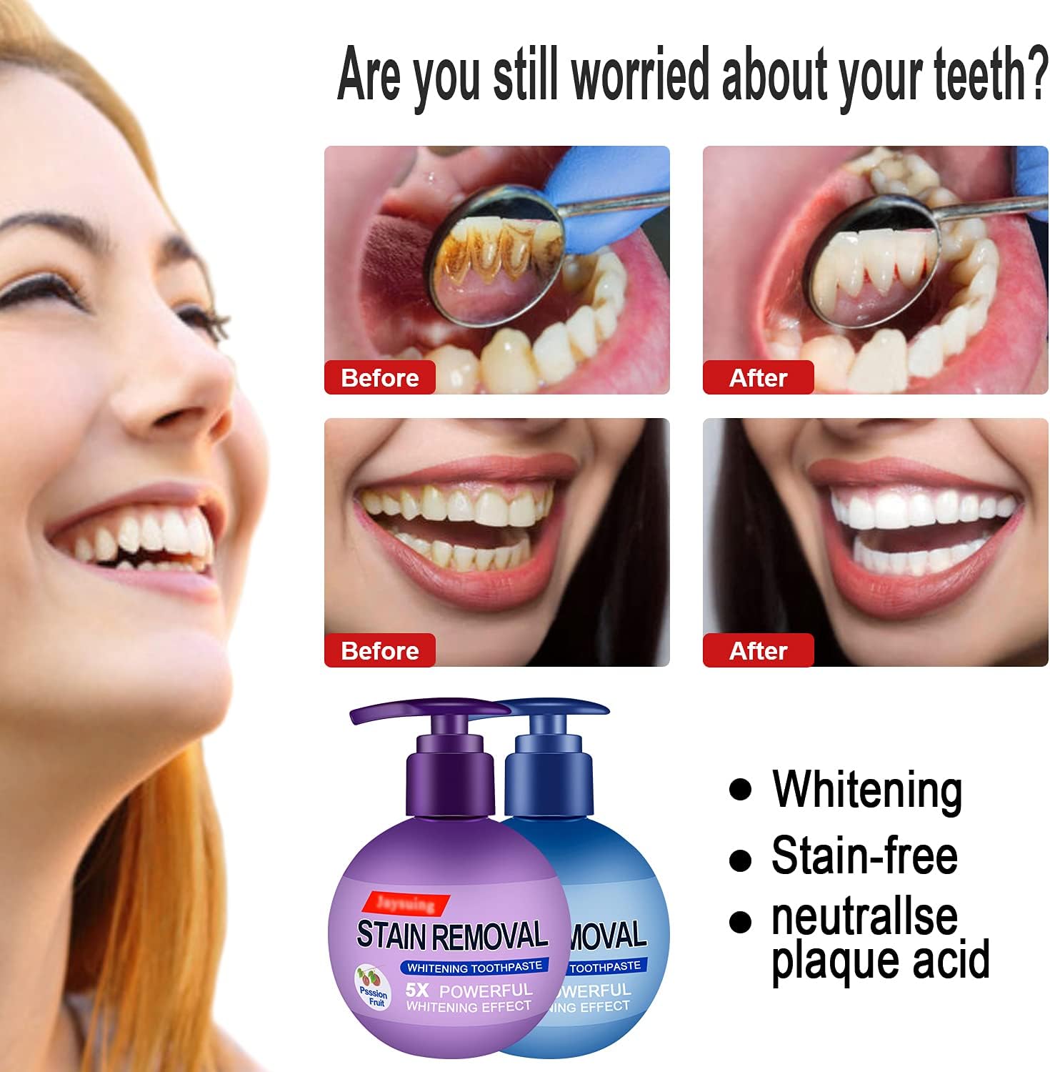 Baking Soda Whitening Toothpaste, Intensive Stain Remover Whitening