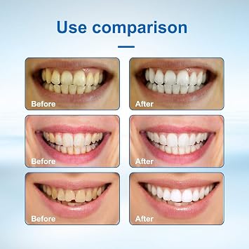 60ml Tooth Armor Liquid,Cavity Healing Tooth Armor,Advanced Too/th Repair Kit for Cavity,Teeth Whitening Drops,Dental Care Liquid,Strengthen Teeth,Soothe Sensitivity,Enamel Strengthening