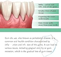Vista 5 de DentiZen - Gotas para aliviar las encías, gotas líquidas naturales para dientes y encías, 2