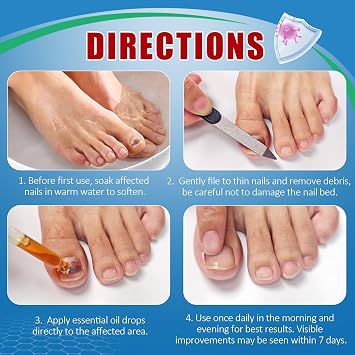 Toenail Fungus Treatment Maximum Strength, Nail Fungus Treatment for Thick, Broken, Discolored & Damaged Nail, Ingrown nails, Natural Plant Extracts, 30ml