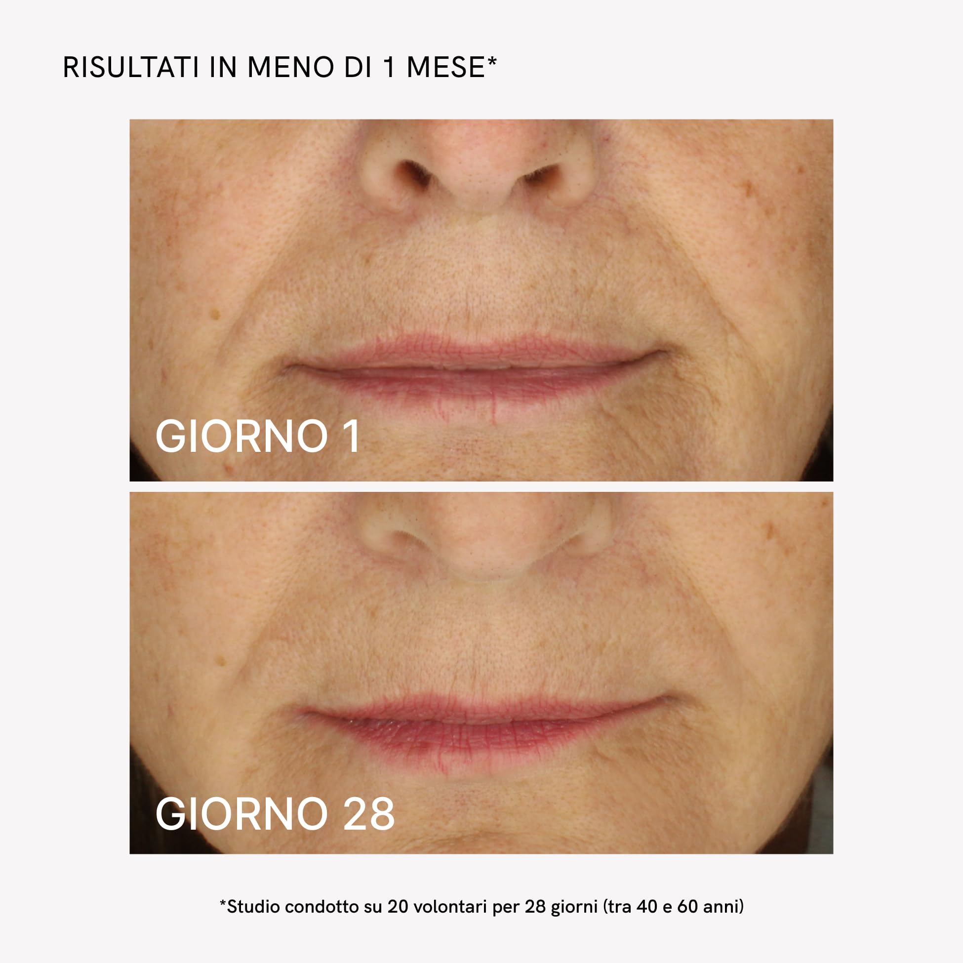MASDERM Radiofrequenza Facciale Professionale con Crema Rassodante 500 ml, Massaggiatore Viso Elettrico Lifting 2 Pack