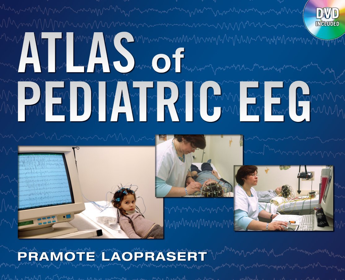 Buy Atlas of Pediatric EEG (Atlas Series) Book Online at Low Prices in