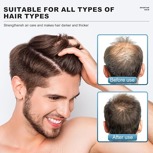 Miniatura 5 de Champú activador de raíces para hombres, sistema de fortalecimiento y suavizado para adelgazamiento y canas, añade volumen y nutre las hebras,