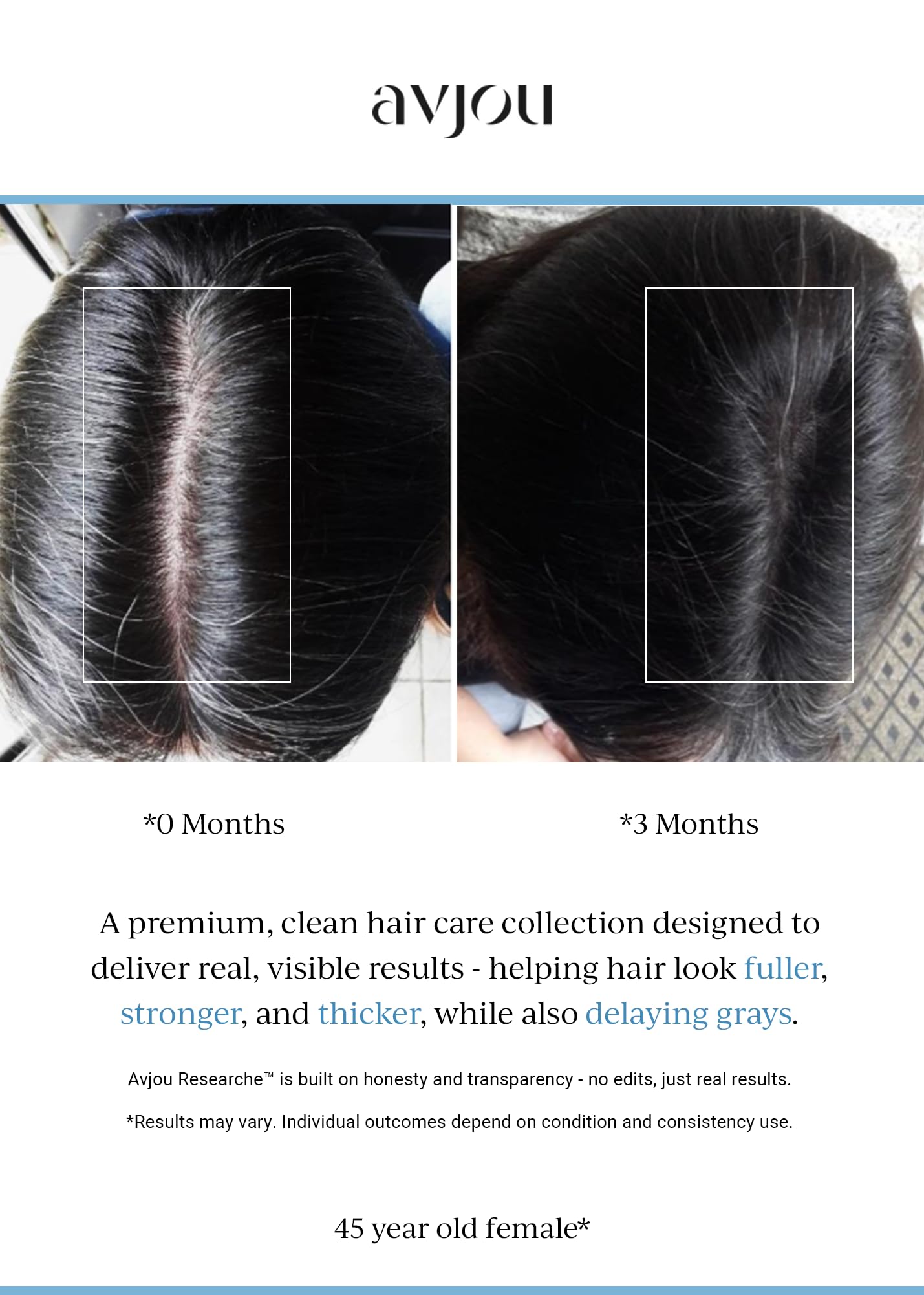 Przeciwstarzeniowe serum do włosów przetestowane klinicznie przywraca naturalny kolor włosów przywraca siwe włosy grubsze i pełniejsze włosy, nietoksyczne, odpowiednie do wszystkich rodzajów włosów 50