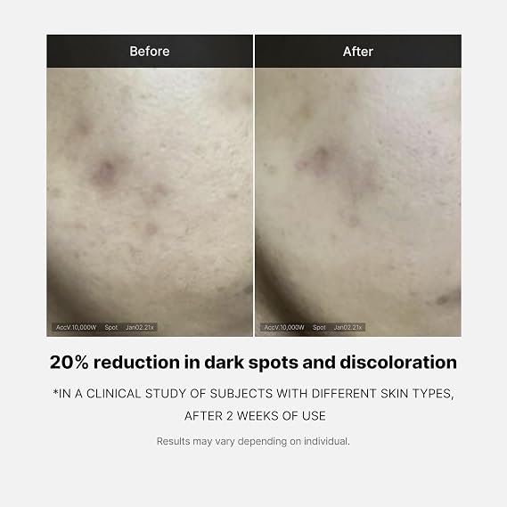 medicube Deep Vita C Serum 2.0 - Pure Vitamin C for Radiance & Glow | Helps Improve the Look of Uneven Skin Tone, Korean Skincare, 10 g x 3 Bottles