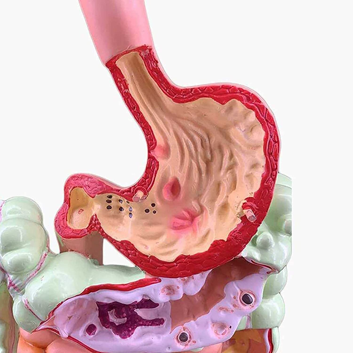 Modello intestinale colorettale Modello autonomo di digestione Umana, intestino crasso e Due organi rettali e duodenali e intestinali. Anatomia gastrointestinale Speciale Medica