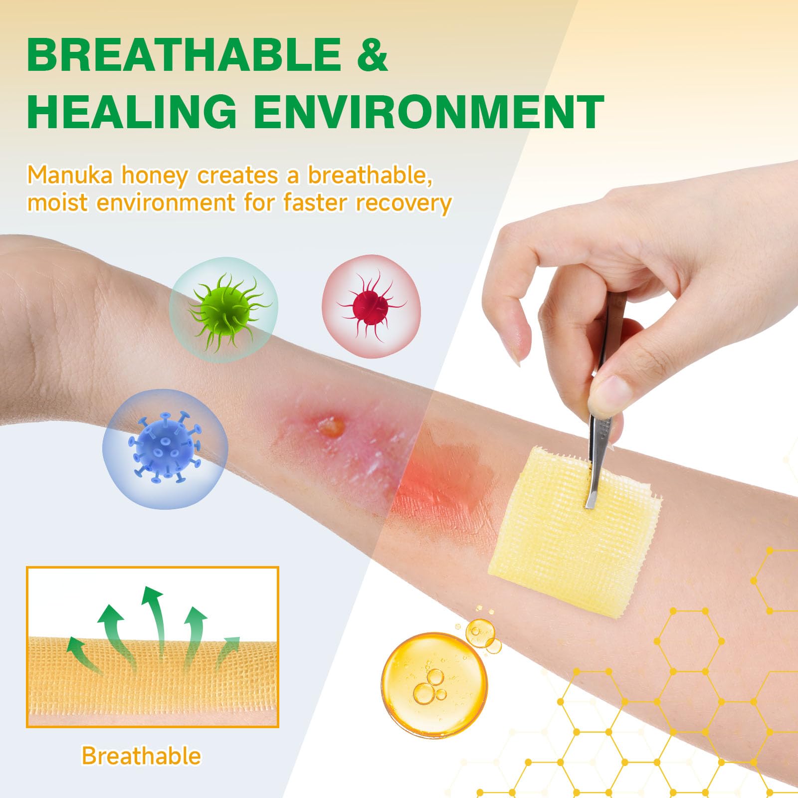 Manuka Honey Gauze Dressings - 12 Pack -2