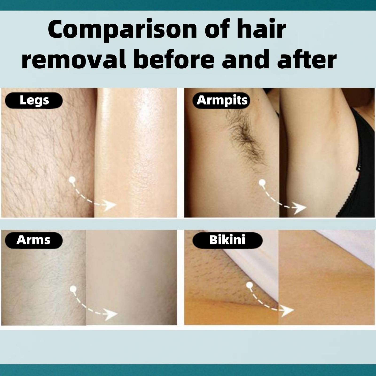 Luz Pulsada Depiladora Pro 2.0 con luz pulsada 2 en 1 para mujer y hombre, depilación cara, bikini y cuerpo, tecnología avanzada para resultados duraderos (Blanco roto)