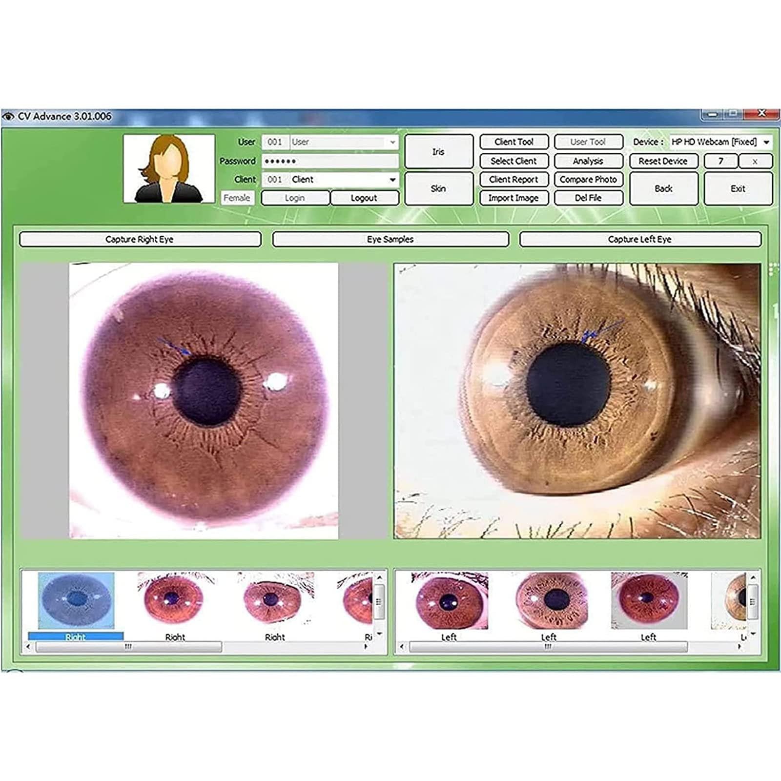 Amazon.co.jp: 虹彩学カメラ、5.0 MP虹彩アナライザー虹彩鏡分析カメラ