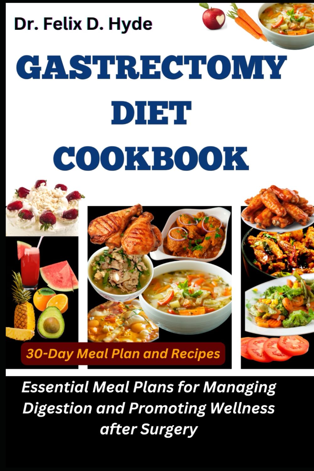 Gastrectomy Diet Cookbook: Essential Meal Plans for Managing Digestion and Promoting Wellness after Surgery