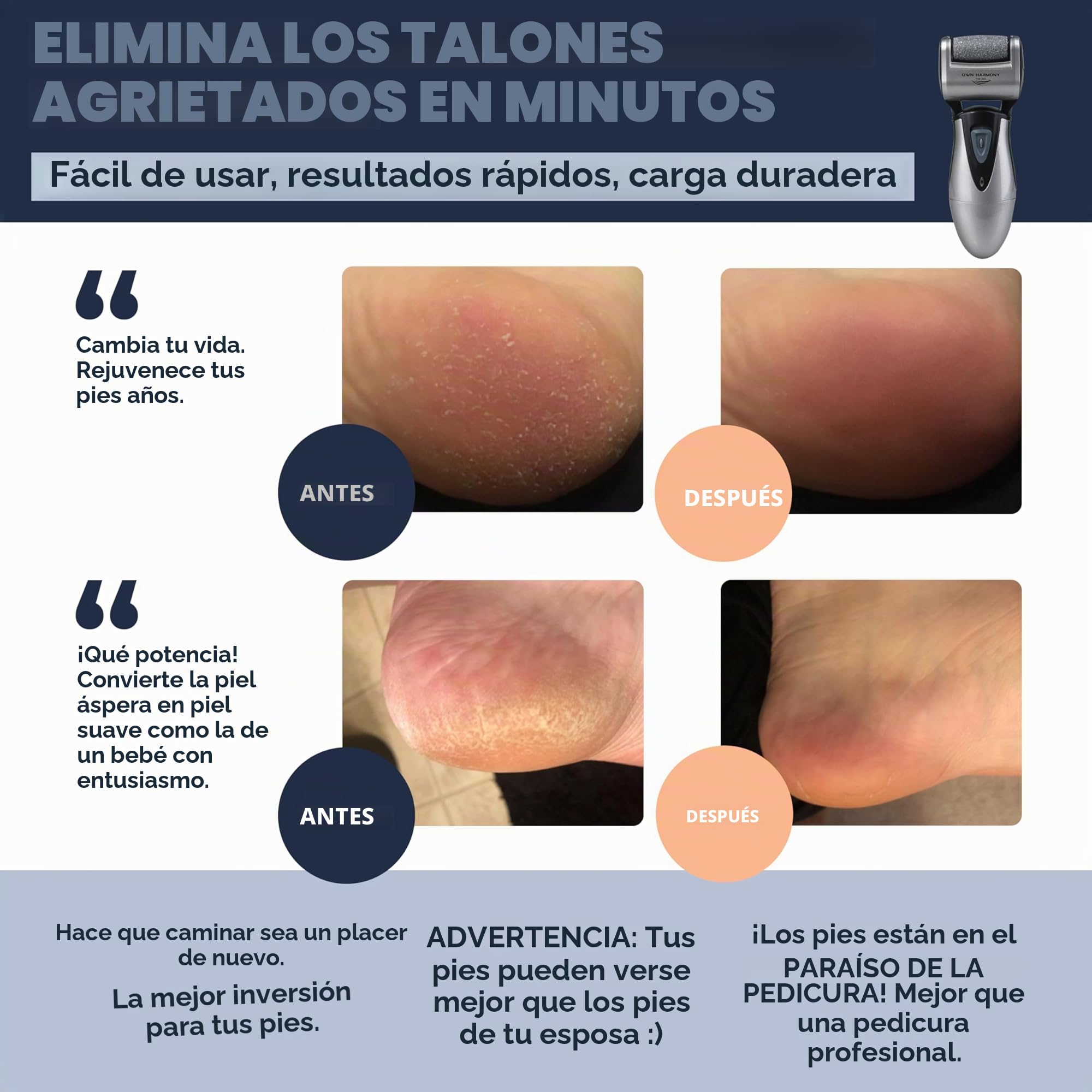 Lima-Electrónica para el Cuidado de los Pies de Hombres Own Harmony - Profesional y Poderoso - Recargables Aparato de Pedicura Eléctrico con 3 Diamond Rodillos - Elimina Piel Seca y Endurecida