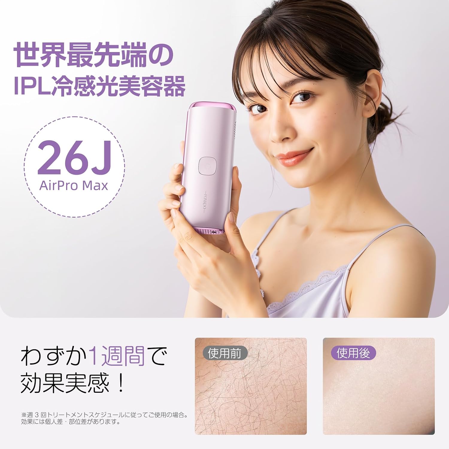 Устройство для удаления волос PURLE, IPL салонного класса, Легкое устройство для удаления волос, под наблюдением косметологов, Запатентованная технология охлаждения сапфиром, Ощущение двойного льда, 41°F (5°C), Автоматическое непрерывное голограммное охлаждение фиолетовым сапфиром X Полупроводниковая технология охлаждения Air Pro Max 26j, фото 2