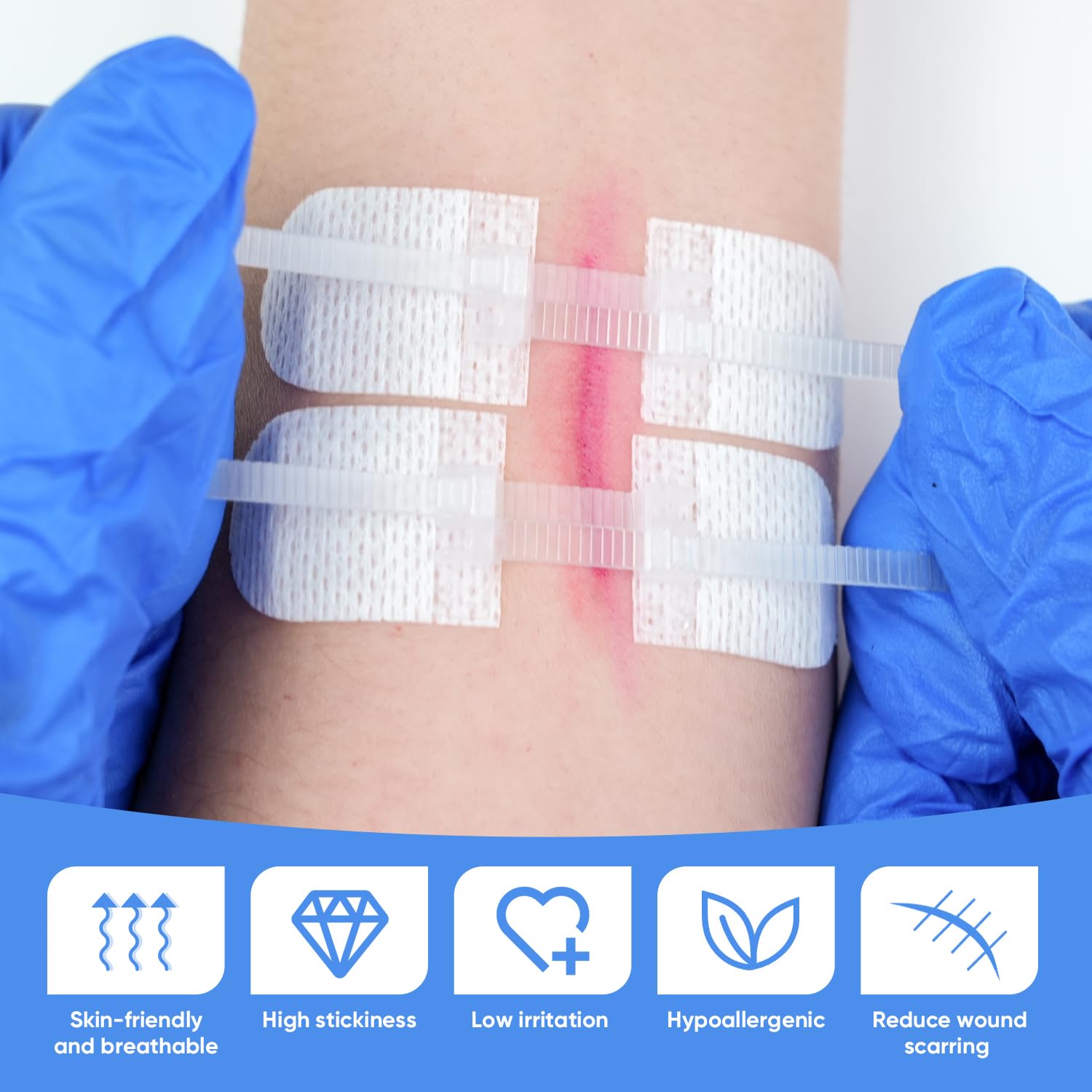 Emergency Wound Closure Kit for Lacerations, 6pcs with Dresssings, First Aid Zip Stitch Bandage Devicefor Cut Care, Skin Closures, Outdoor Survival, Trauma Care, Medical Emergency Preparedness Supplies