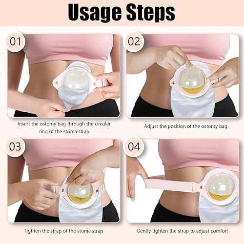 Miniatura 7 de Paquete de 3 cinturones de ostomía para mujeres y hombres, cinturón de ostomía ajustable que se fija de forma segura a la bolsa de ostomía de 1.18 x
