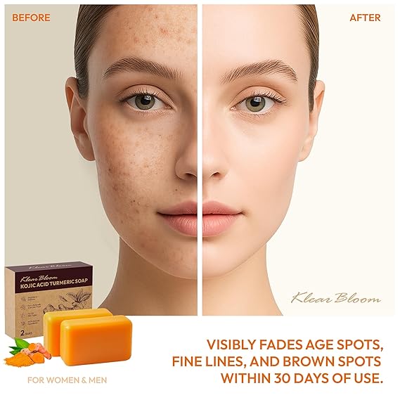 Kojic Acid Soap, Turmeric Soap Bar for Dark Spots Brightening & Moisturizing with Collagen, Vitamin E, Retinol, Hyaluronic Acid, Shea Butter, Paraben & Sulfate-Free 105g x 2 Bars