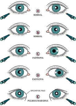 Ophthalmology Made Ridiculously Simple: Color Edition