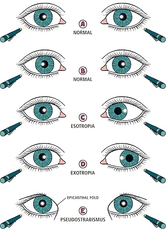 Ophthalmology Made Ridiculously Simple: Color Edition