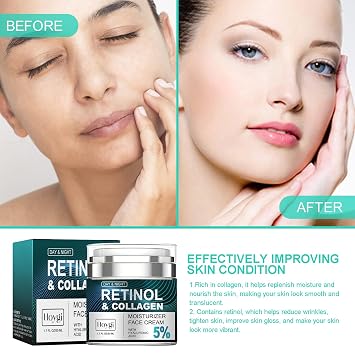 AMALIA Retinol & Collagen Face Cream, 5% Hyaluronic Acid Moisturizer, Day & Night Anti-Aging Formula, 1.7 FL OZ