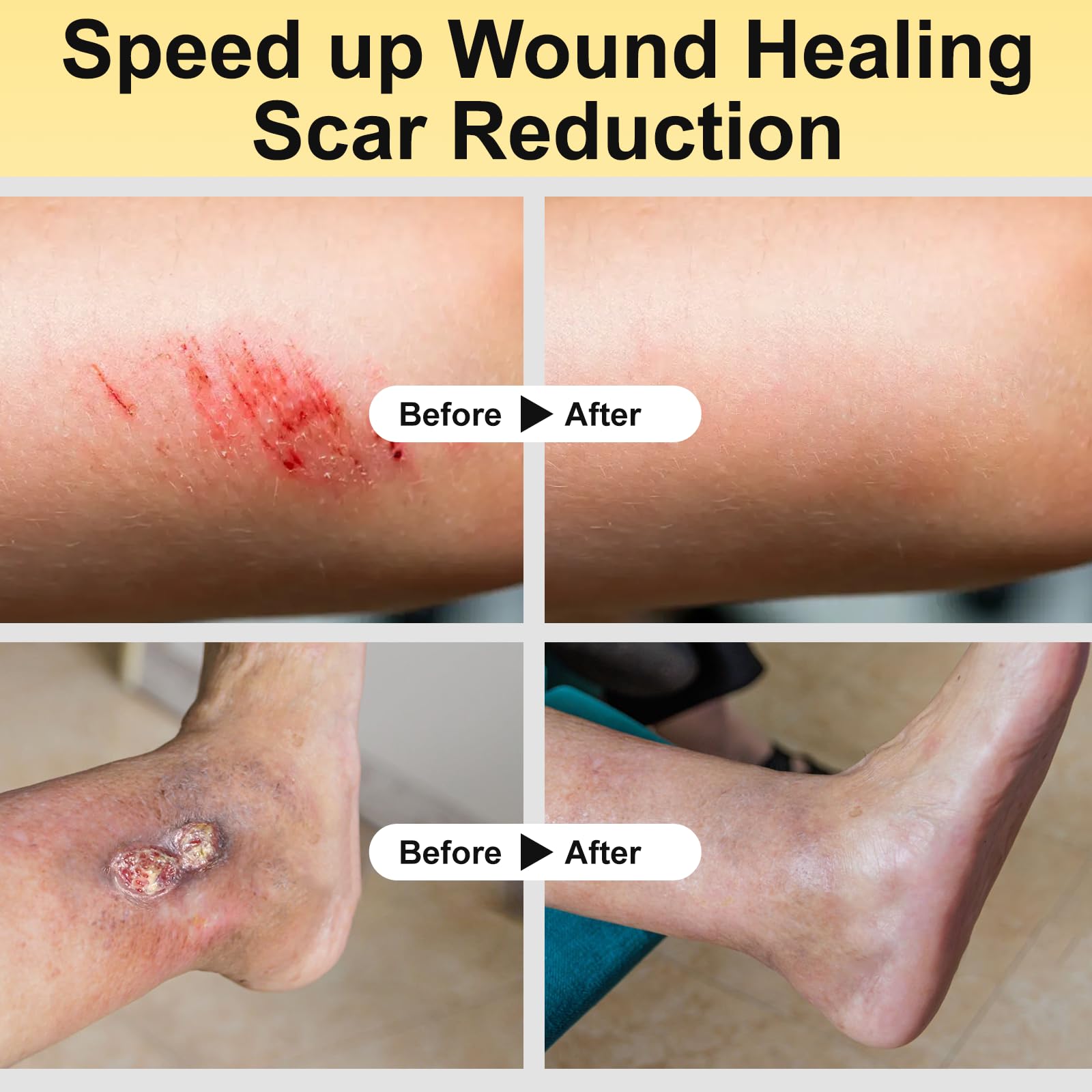 Manuka Honey for Wounds, Speed up Healing for Cuts, Surgical Wounds, Scars, Foot Ulcers, Infection, Burns, Non-Sticky, Easy to Apply, 40g — Amazon image 5