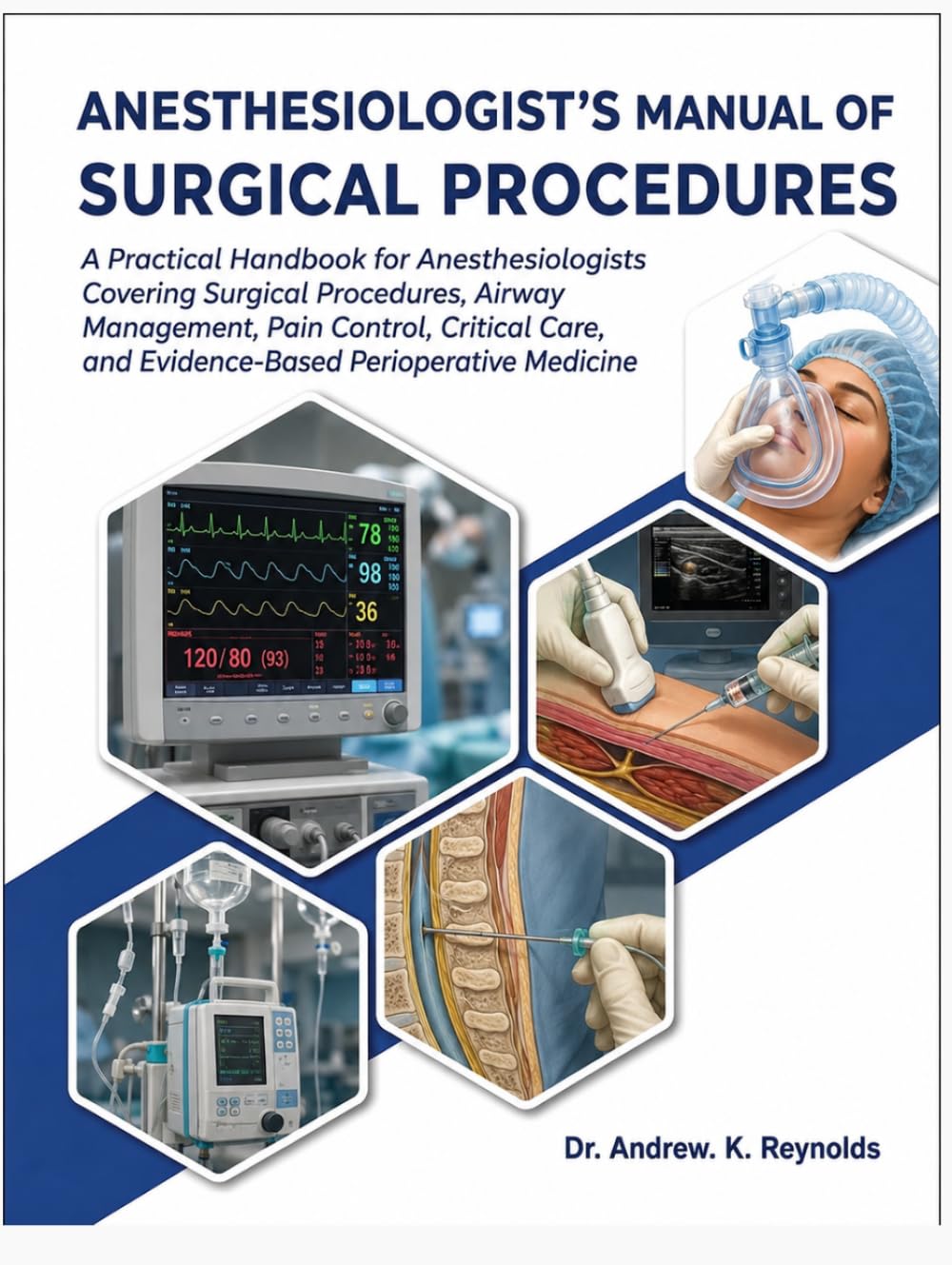 ANESTHESIOLOGIST'S MANUAL OF SURGICAL PROCEDURES: A Practical Handbook for Anesthesiologists Covering Surgical Procedures, Airway Management, Pain ... and Evidence-Based Perioperative Medicine