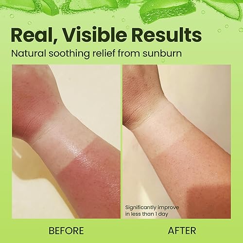 Miniatura 5 de Gel orgánico de Aloe Vera gel 100 puro de Aloe con miel de Manuka Cuidado facial y del cuerpo después del sol Gel de hoja de Aloe para quemaduras