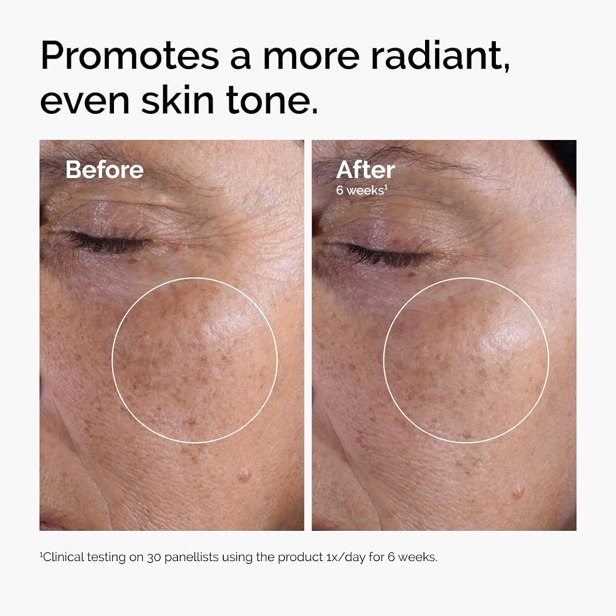 The Ordinary Glycolic Acid 7% Exfoliating Toner, Brightening and Smoothing Daily Toner for More Even-Looking Skin Tone 3.4 Fl Oz (Pack of 1) image 1